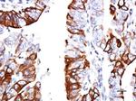 GPR30 Antibody in Immunohistochemistry (Paraffin) (IHC (P))