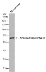 ACVR1 Antibody in Western Blot (WB)