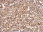 PAK6 Antibody in Immunohistochemistry (Paraffin) (IHC (P))