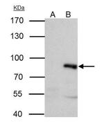 PAK6 Antibody in Immunoprecipitation (IP)