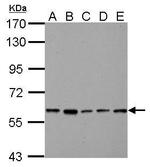 PKLR Antibody in Western Blot (WB)