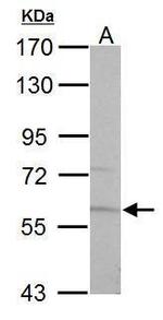 PKLR Antibody in Western Blot (WB)