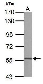 PKLR Antibody in Western Blot (WB)