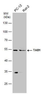 TAB1 Antibody in Western Blot (WB)