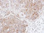 CSK Antibody in Immunohistochemistry (Paraffin) (IHC (P))