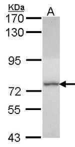 DDX1 Antibody in Western Blot (WB)