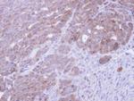 CoA Synthase Antibody in Immunohistochemistry (Paraffin) (IHC (P))