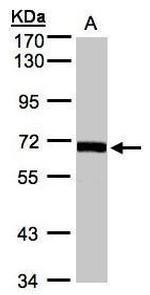 CoA Synthase Antibody in Western Blot (WB)