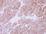 UGP2 Antibody in Immunohistochemistry (Paraffin) (IHC (P))