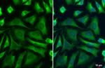 PKM2 Antibody in Immunocytochemistry (ICC/IF)