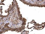 PKM2 Antibody in Immunohistochemistry (Paraffin) (IHC (P))