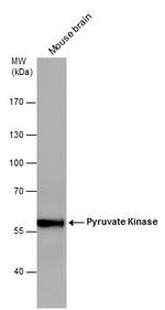 PKM2 Antibody in Western Blot (WB)