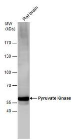 PKM2 Antibody in Western Blot (WB)