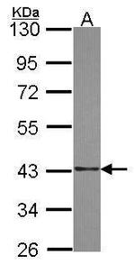 SAE1 Antibody in Western Blot (WB)