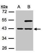 SNUPN Antibody in Western Blot (WB)