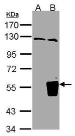 TRIM15 Antibody in Western Blot (WB)