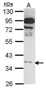 GPR81 Antibody in Western Blot (WB)