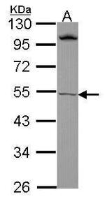 RORB Antibody in Western Blot (WB)