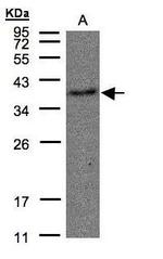 TBXA2R Antibody in Western Blot (WB)