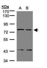 LGR7 Antibody in Western Blot (WB)