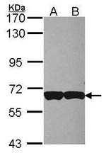 CD97 Antibody in Western Blot (WB)