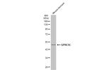 GPRC5C Antibody in Western Blot (WB)