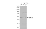 GPRC5C Antibody in Western Blot (WB)