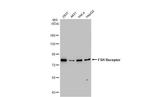 FSHR Antibody in Western Blot (WB)