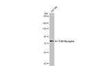 FSHR Antibody in Western Blot (WB)