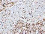 HUNK Antibody in Immunohistochemistry (Paraffin) (IHC (P))