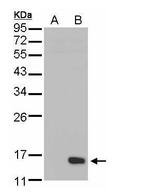 DUSP23 Antibody in Western Blot (WB)