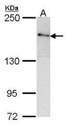 ROCK2 Antibody in Western Blot (WB)