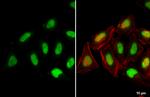 Histone H2A.X Antibody in Immunocytochemistry (ICC/IF)