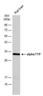 alpha TTP Antibody in Western Blot (WB)