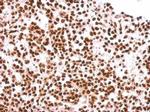 Histone H2A.X Antibody in Immunohistochemistry (Paraffin) (IHC (P))