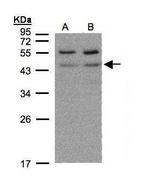 beta-1 Adrenergic Receptor Antibody in Western Blot (WB)