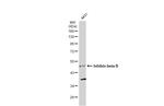 INHBB Antibody in Western Blot (WB)