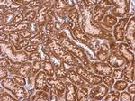 Syntenin 1 Antibody in Immunohistochemistry (Paraffin) (IHC (P))