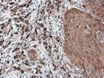 CXCL13 Antibody in Immunohistochemistry (Paraffin) (IHC (P))