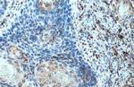 CXCL13 Antibody in Immunohistochemistry (Paraffin) (IHC (P))