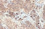 CXCL13 Antibody in Immunohistochemistry (Paraffin) (IHC (P))