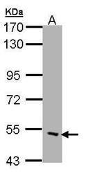 CHRND Antibody in Western Blot (WB)