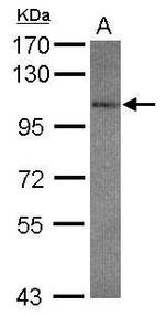 GluR7 Antibody in Western Blot (WB)