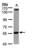 IL1R1 Antibody in Western Blot (WB)