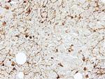 CD122 Antibody in Immunohistochemistry (Paraffin) (IHC (P))