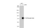 CD122 Antibody in Western Blot (WB)