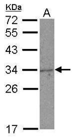 NKG2A Antibody in Western Blot (WB)