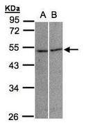 GLRA3 Antibody in Western Blot (WB)