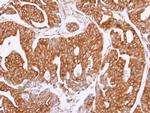 OLFM1 Antibody in Immunohistochemistry (Paraffin) (IHC (P))