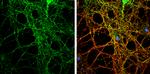 PACSIN1 Antibody in Immunocytochemistry (ICC/IF)